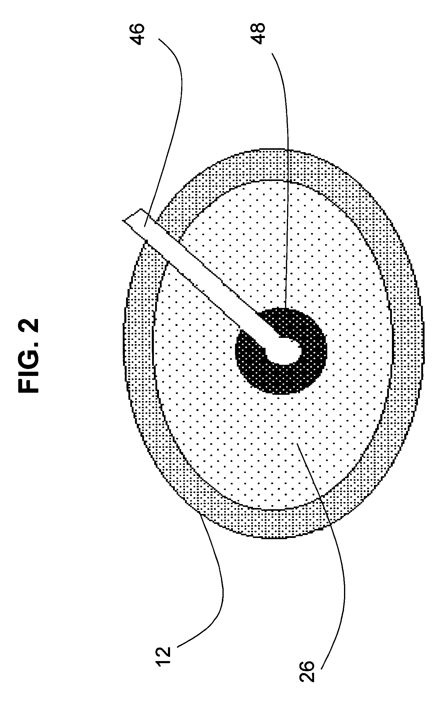 Fluid oxygenator with access port