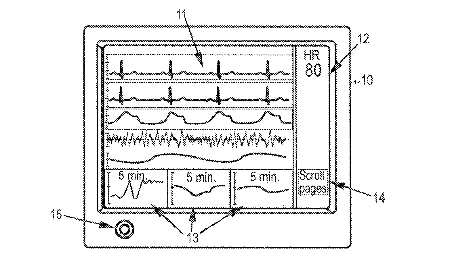 Method, Device and Computer Program Product for Monitoring a Subject