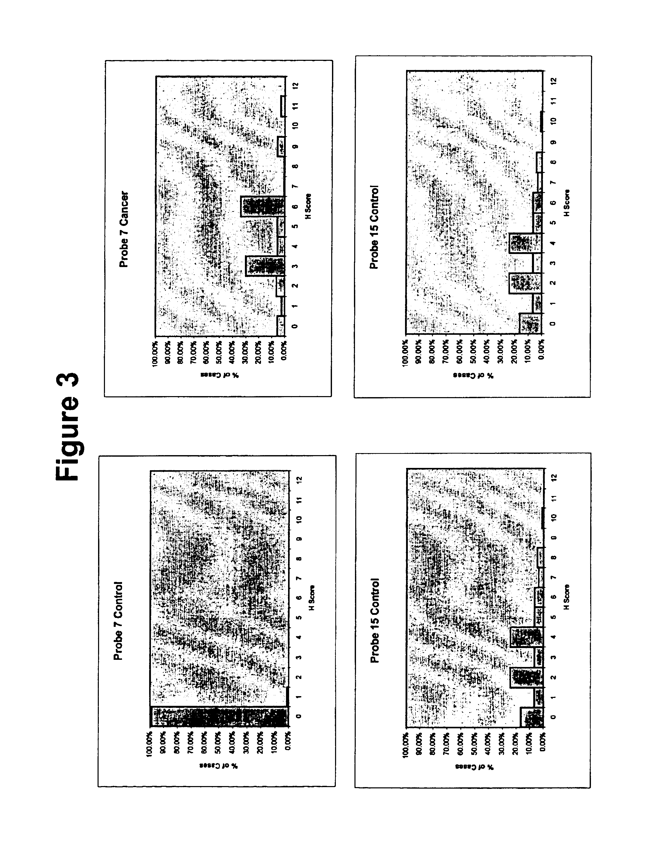 Cell-based detection and differentiation of lung cancer