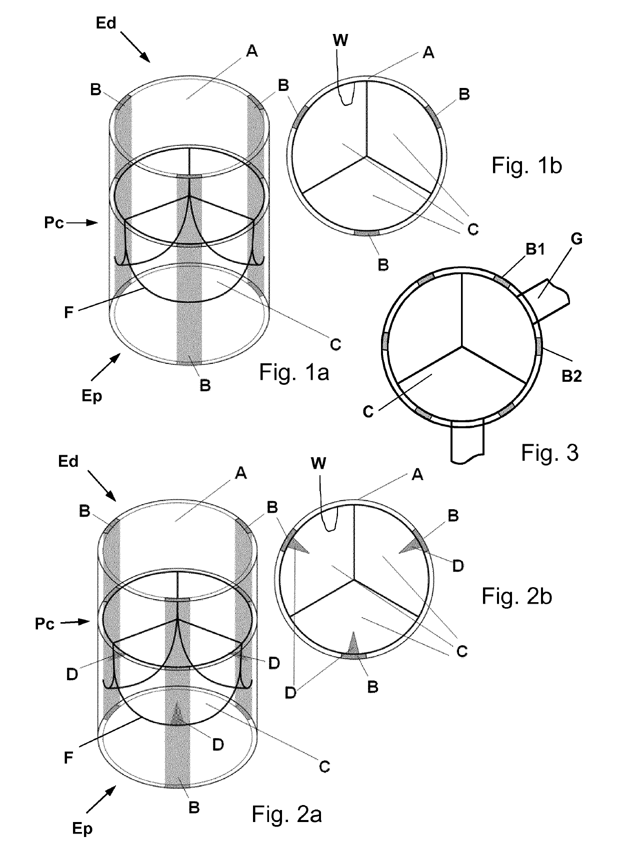 Biological heart valve replacement, particularly for pediatric patients, and manufacturing method