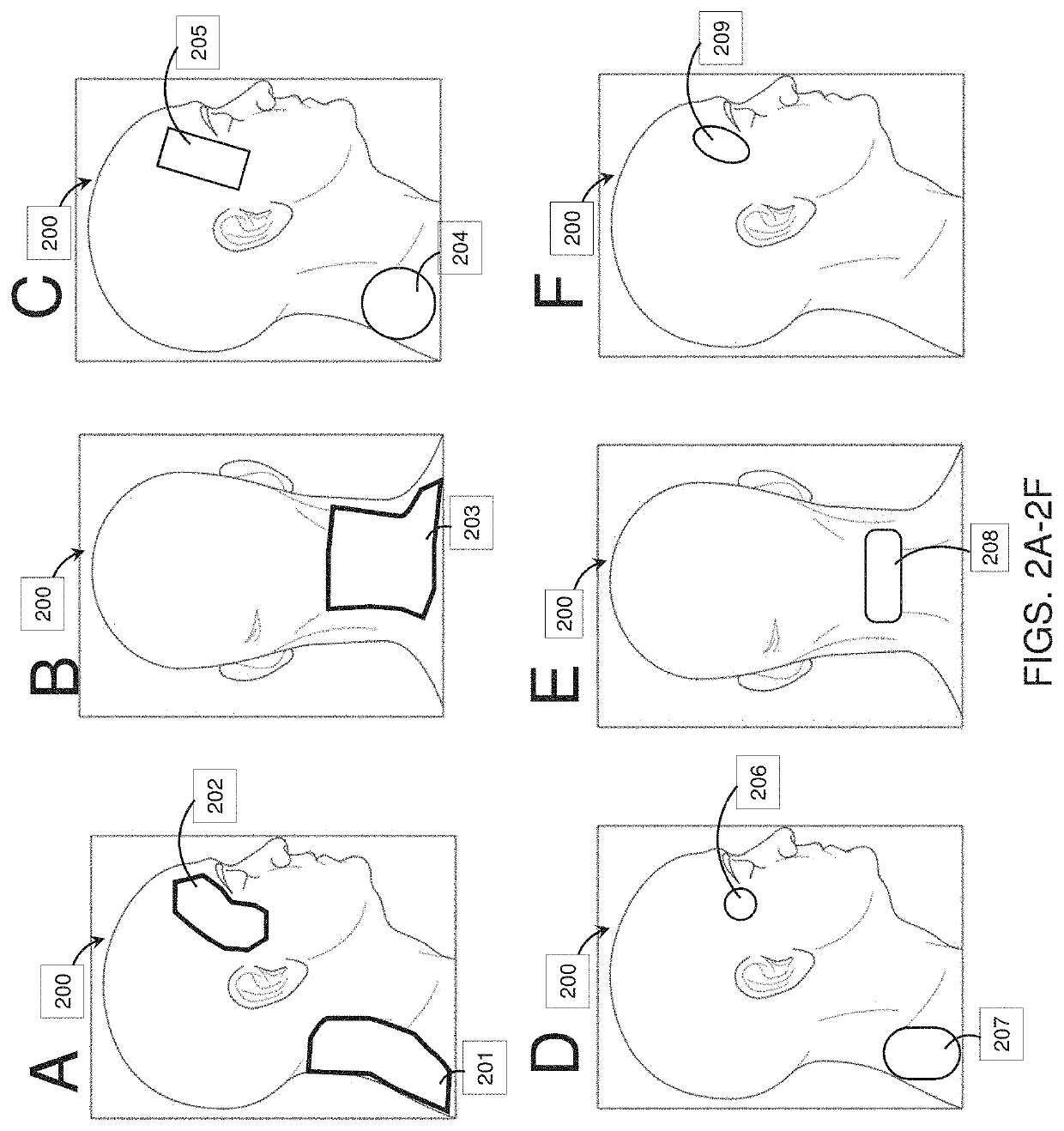 Systems and methods for applying electrical energy to treat psoriasis