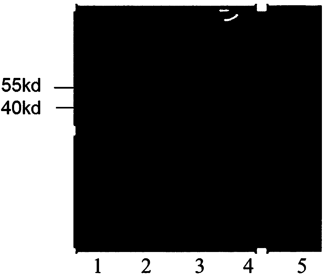 High-throughput screening method of ALKBH5 small molecule inhibitor