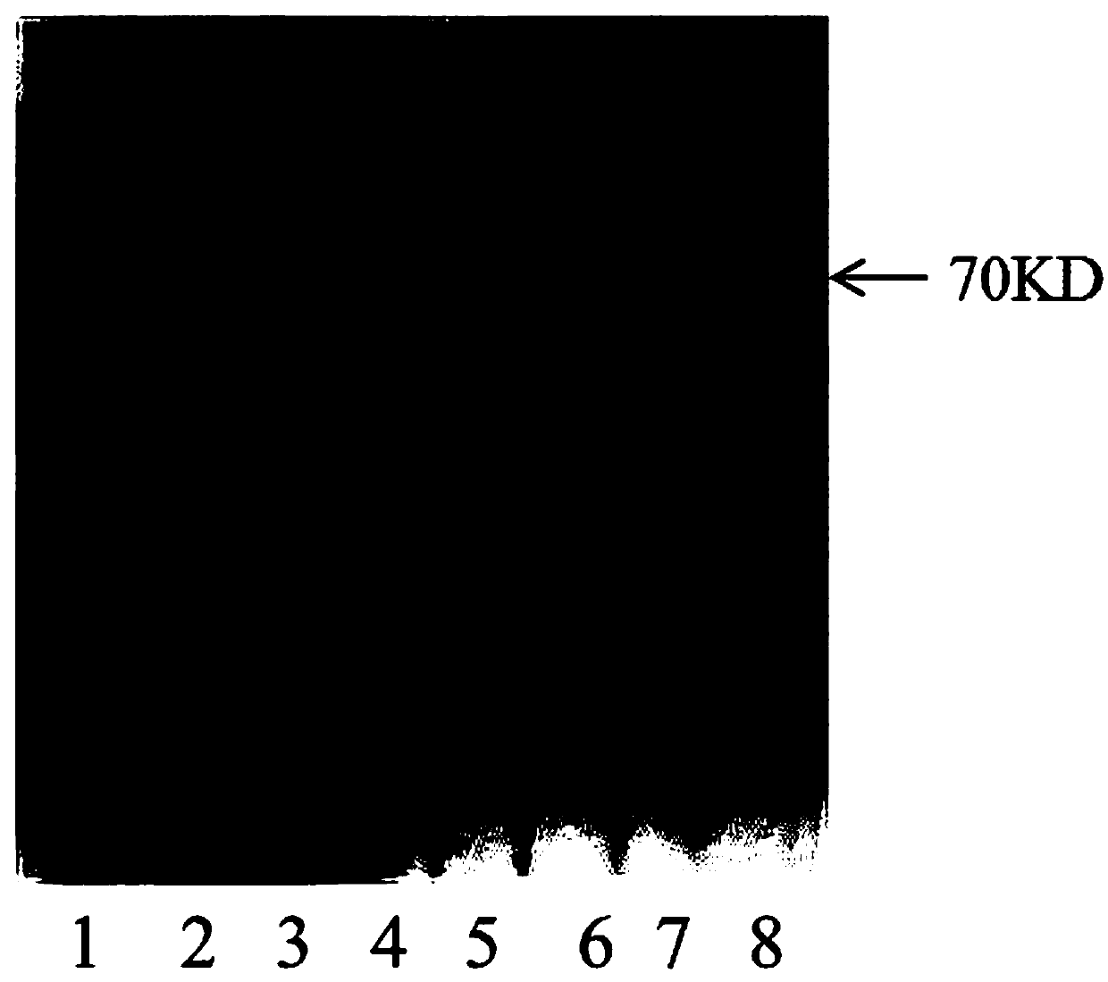 High-throughput screening method of ALKBH5 small molecule inhibitor