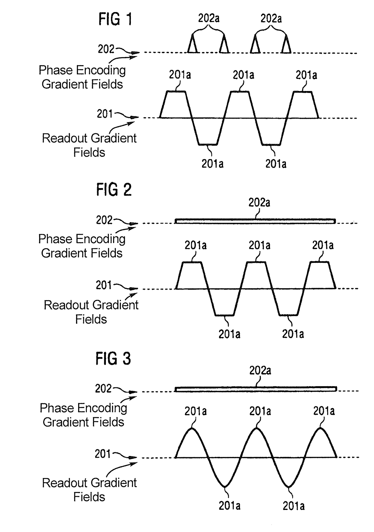 Method and magnetic resonance apparatus for echo planar imaging with data entry into k-space along a zigzag trajectory