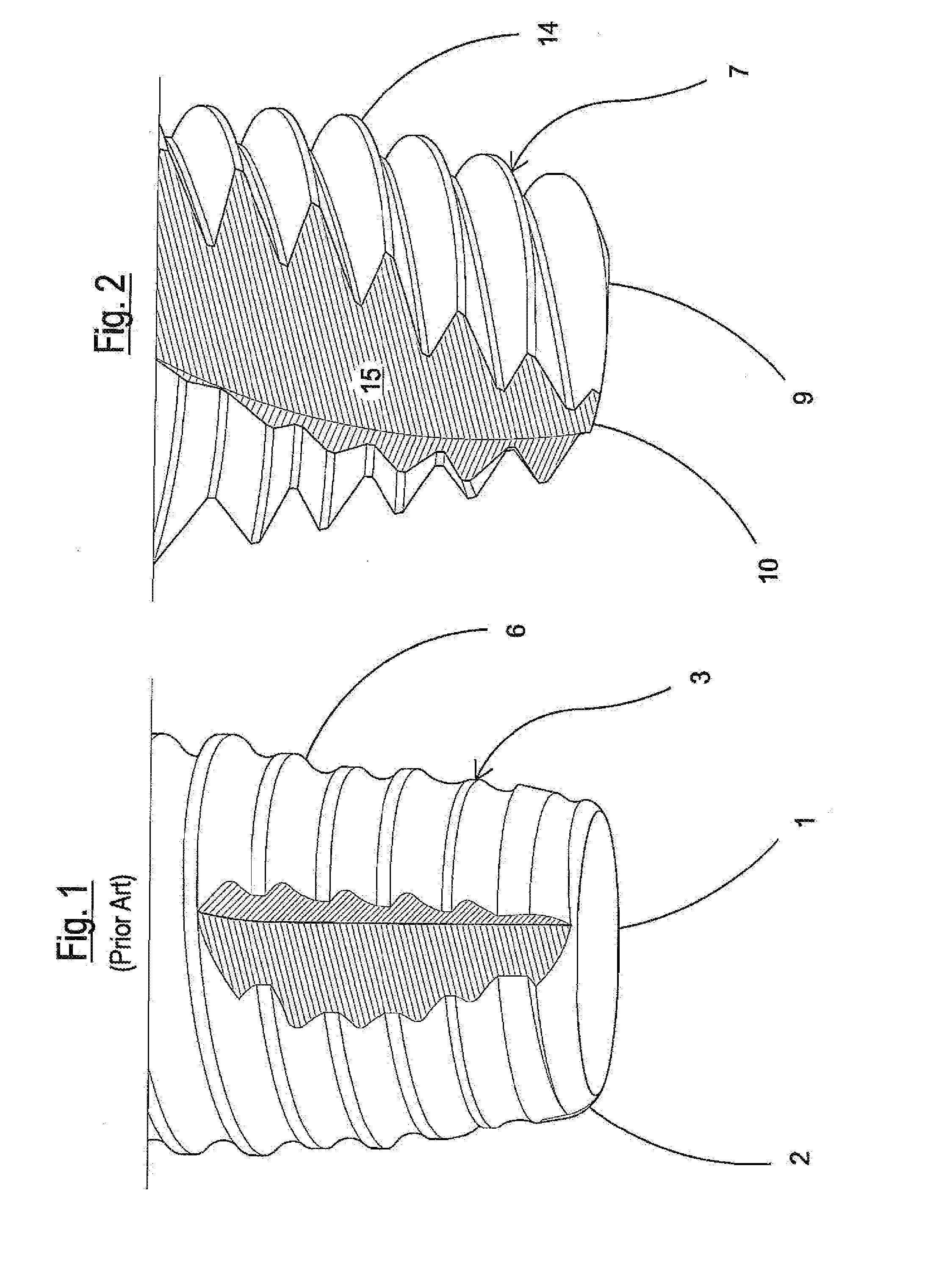 Endosseous implant of the improved type