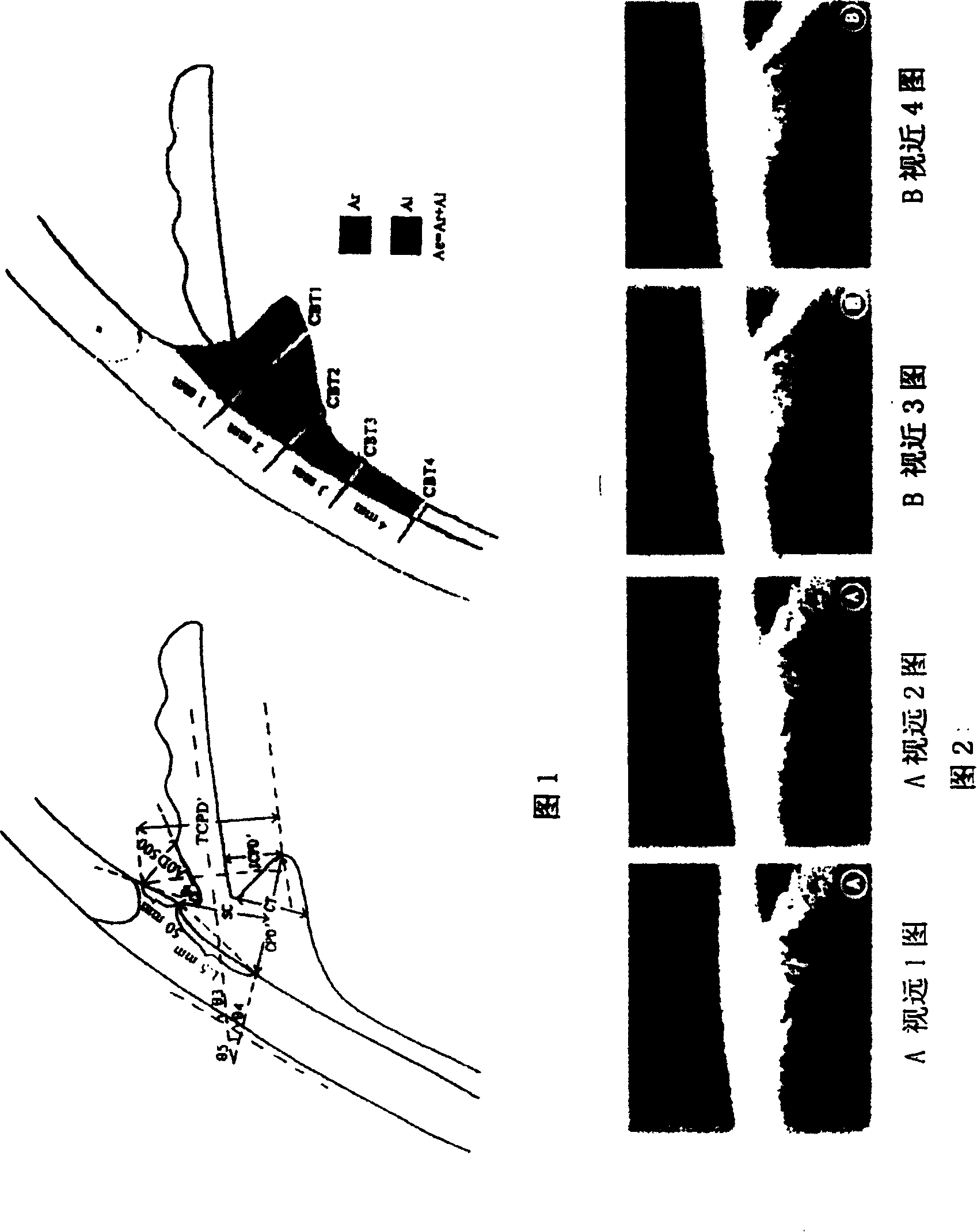 Eye food peptide injection and its use in preparing medincine for treating hypometropia