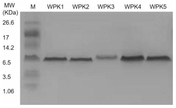 Whitmania pigra anticoagulant factor XIa polypeptide and application thereof