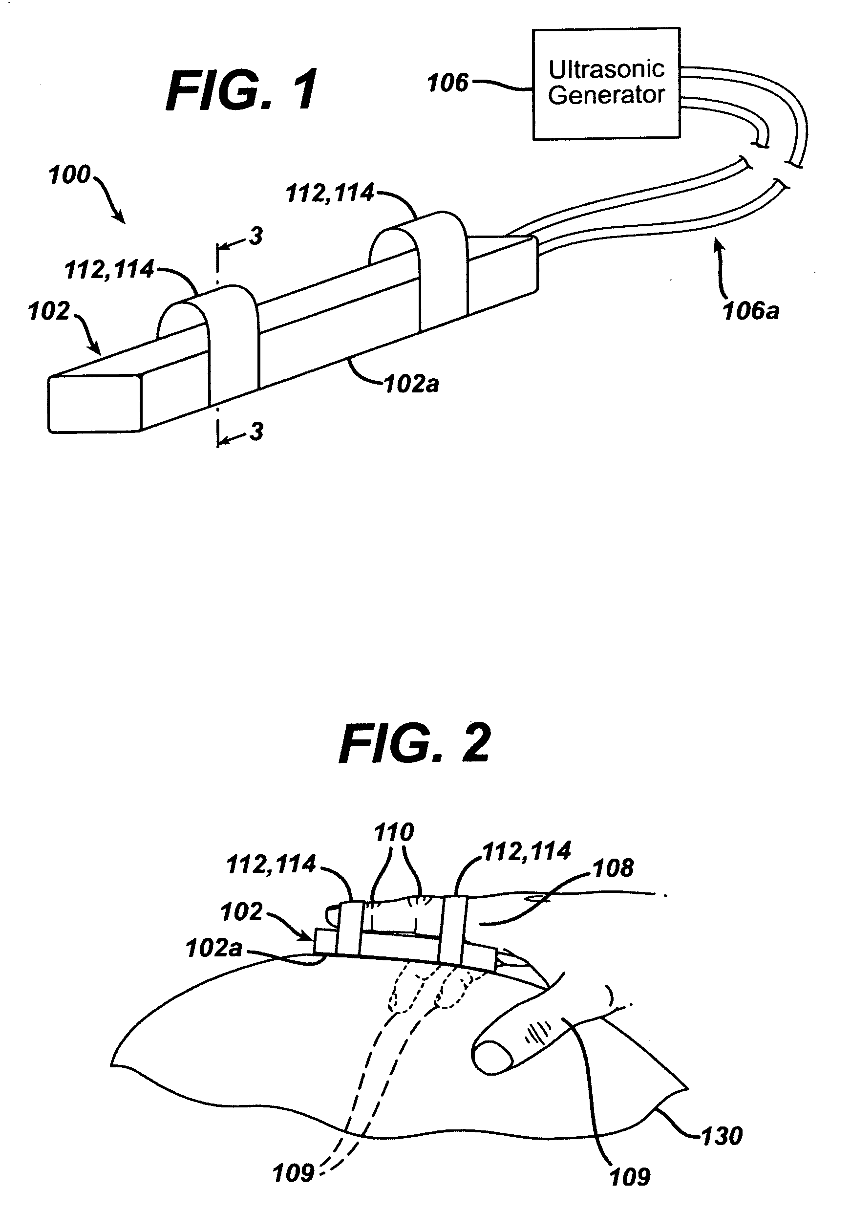 Ultrasonic finger probe