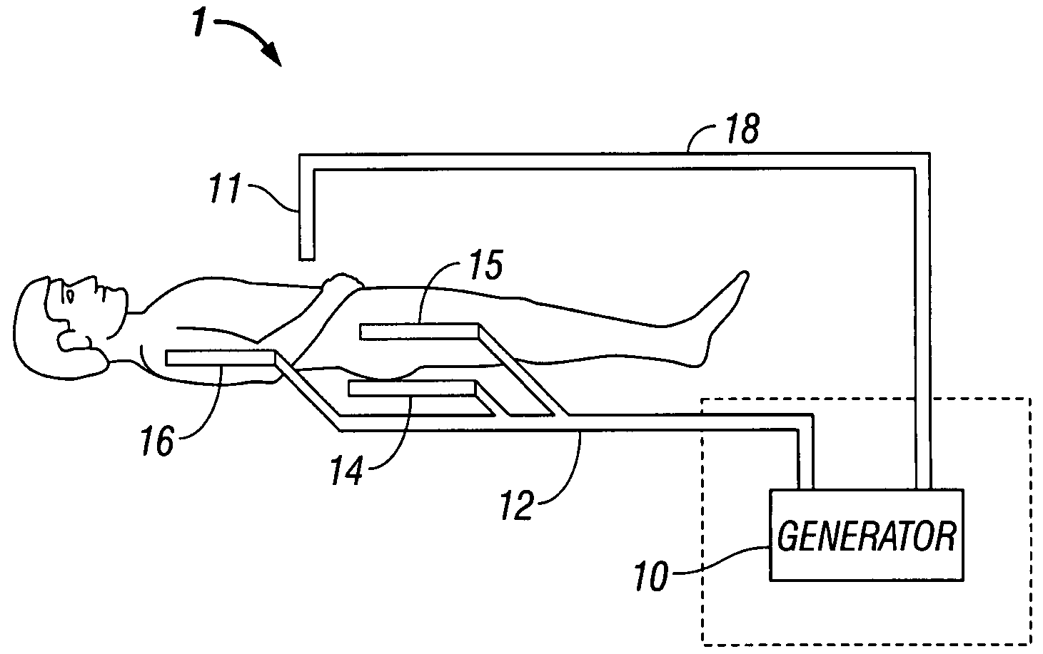 System and method for return electrode monitoring