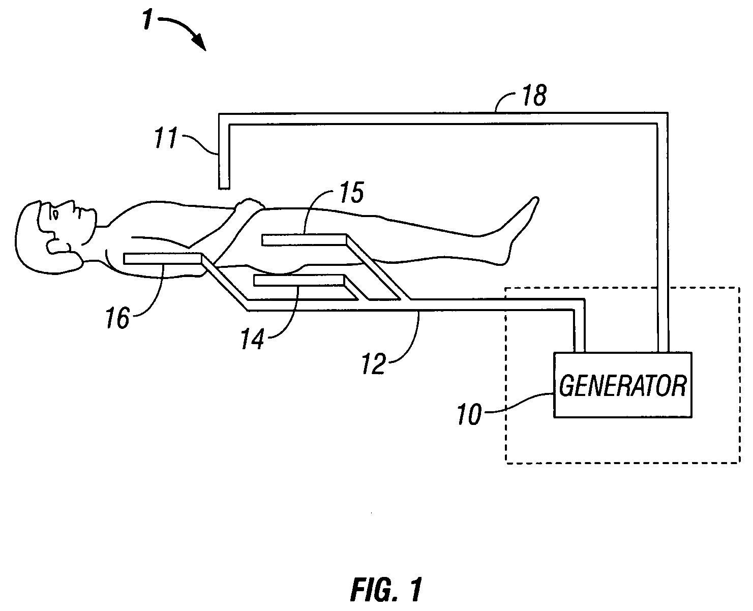 System and method for return electrode monitoring