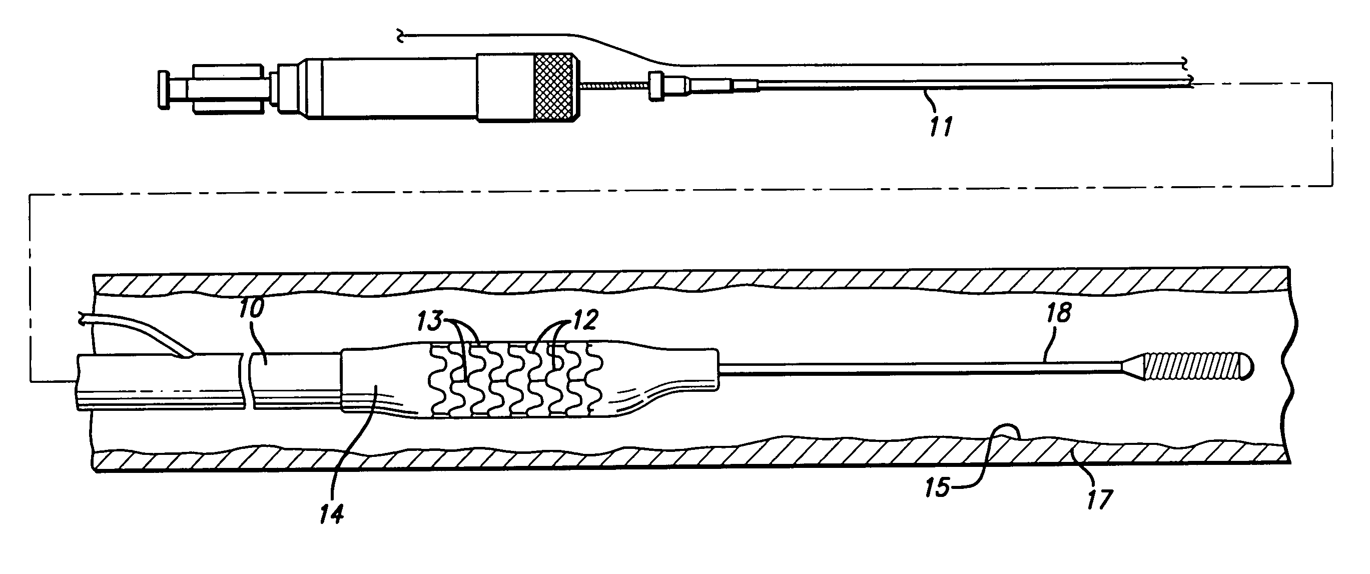 Method and apparatus for thermal spray processing of medical devices