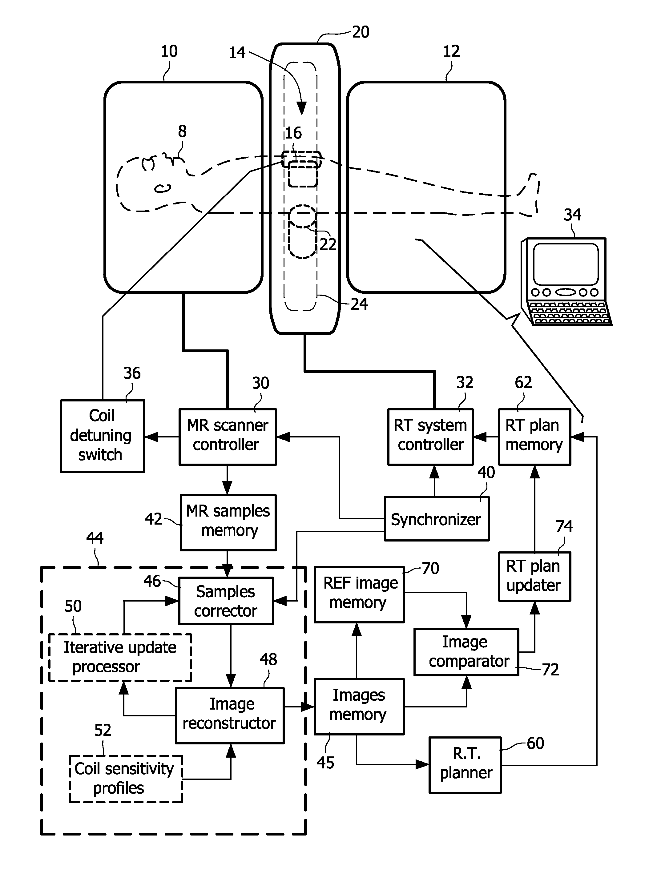 Radiation therapy system with real time magnetic resonance monitoring