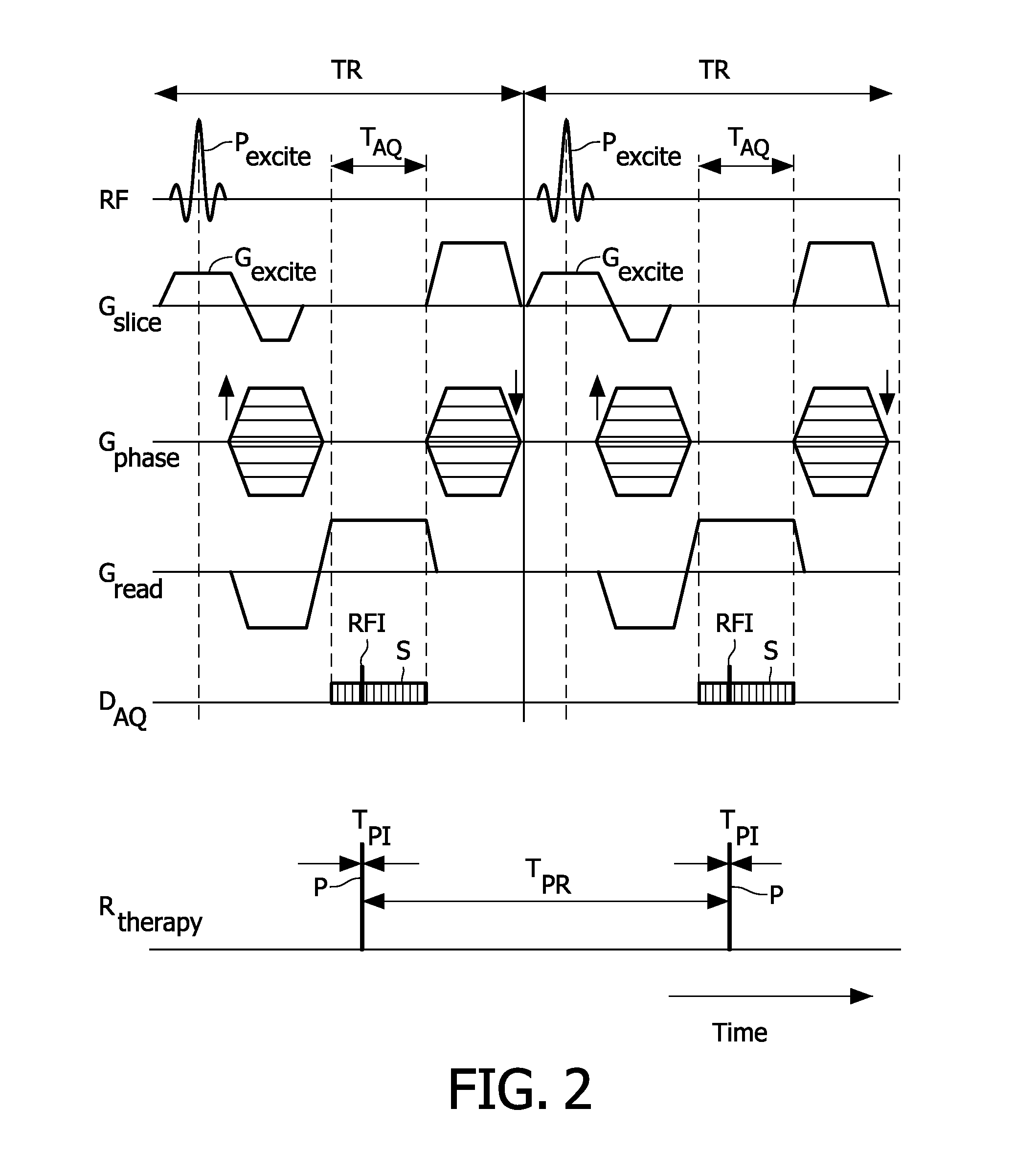 Radiation therapy system with real time magnetic resonance monitoring