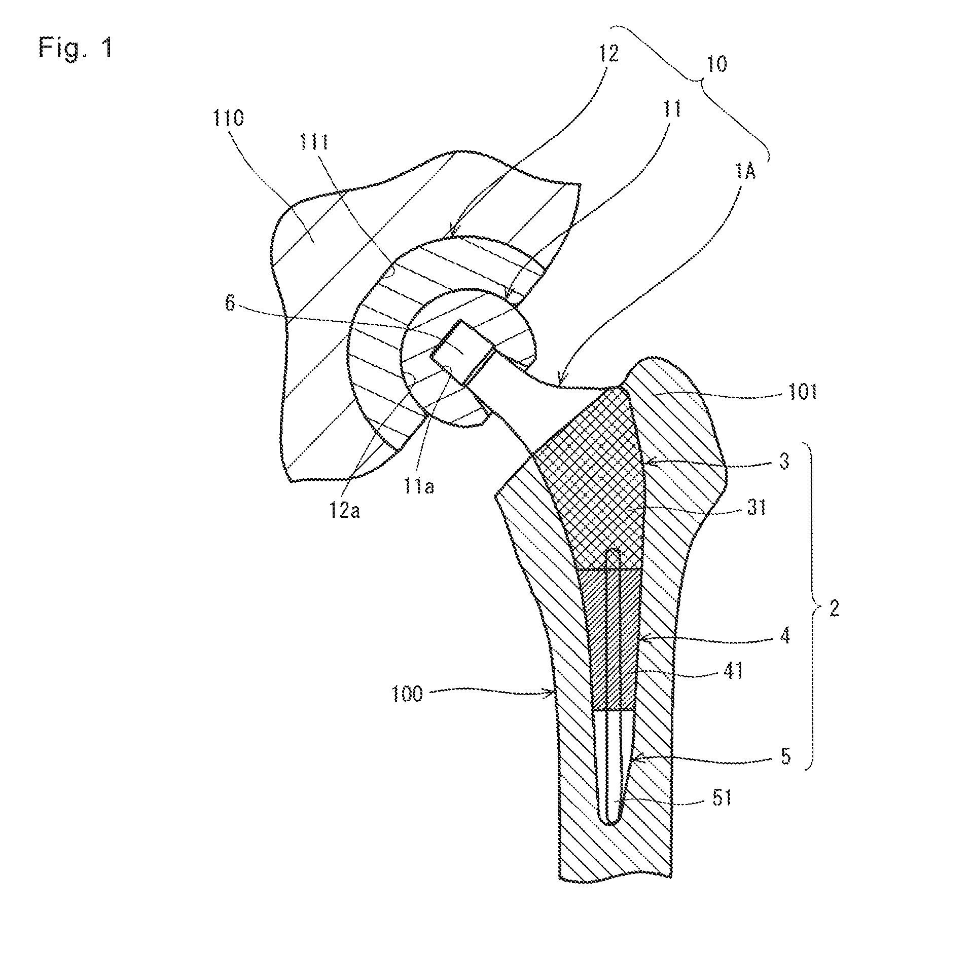 Artificial hip joint stem and artificial hip joint including the same