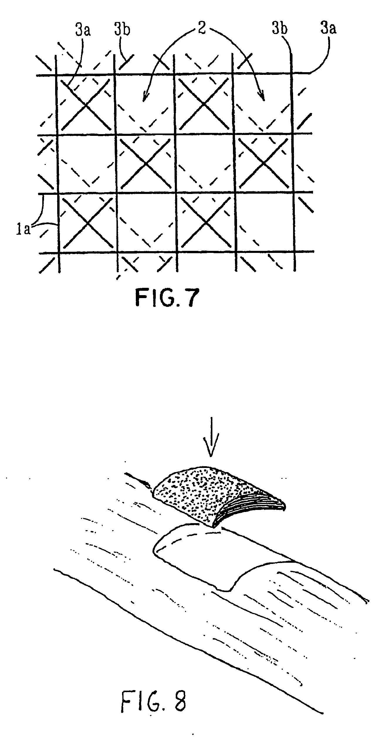 Porous medical device and method for its manufacture