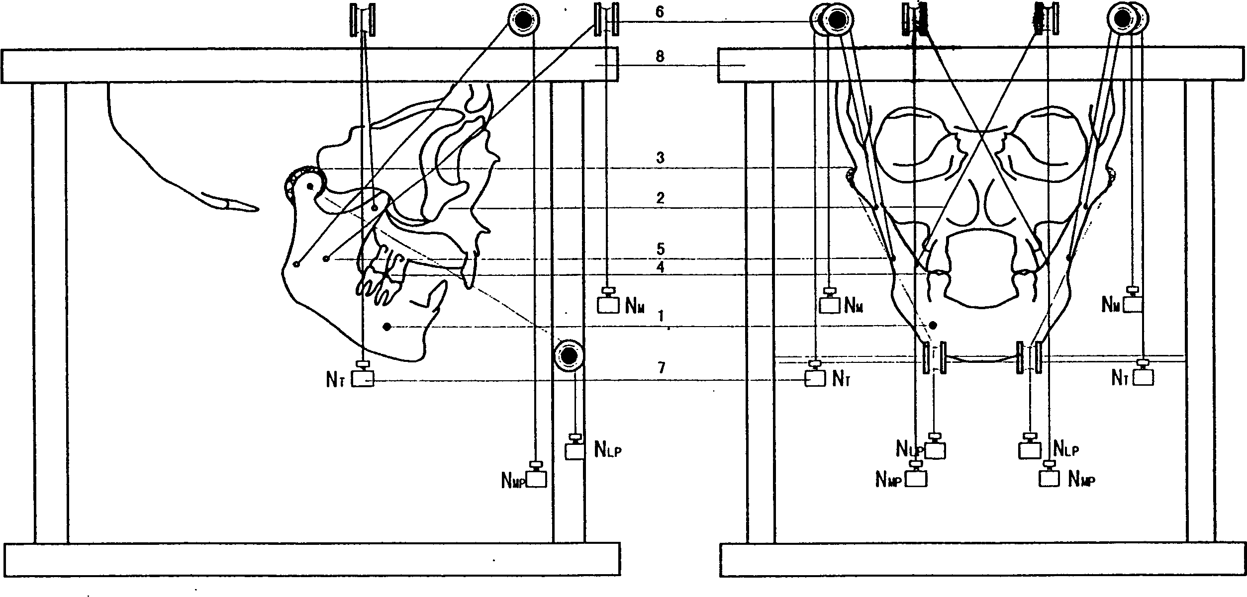 Biomechanical model of human lower jawbone