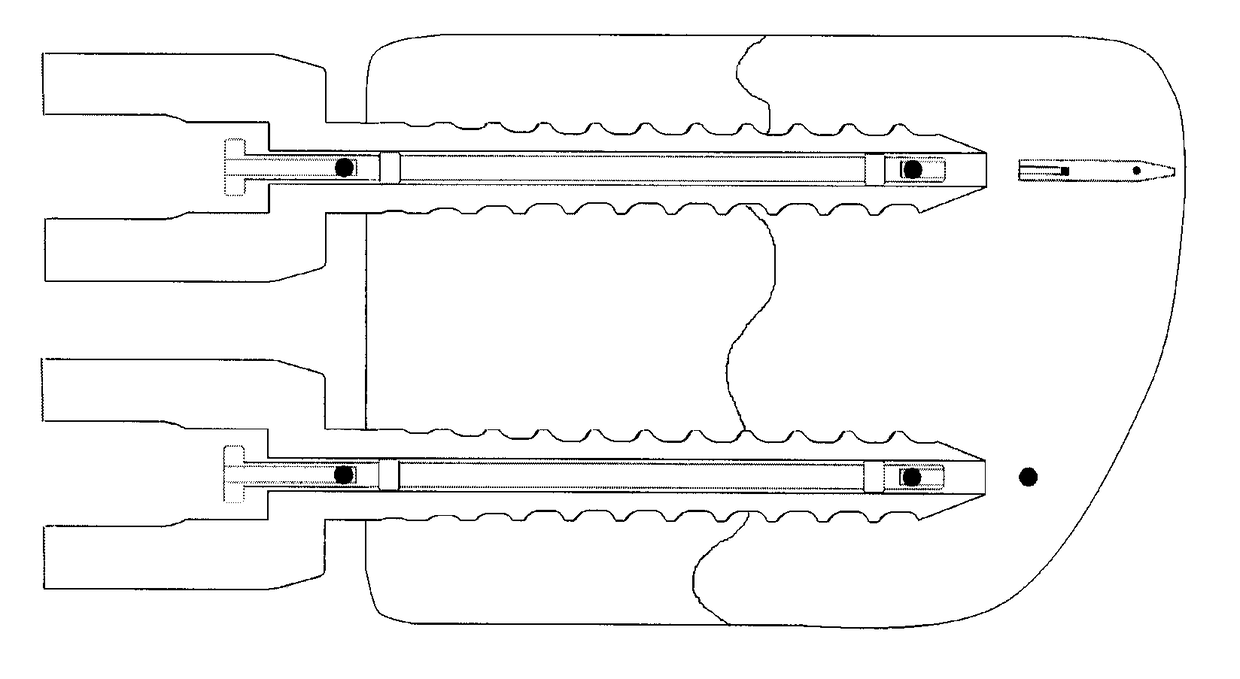 Method of detecting movement between an implant and a bone