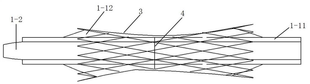 Eustachian tube irrigation-dilation drug delivery integrated device and using method thereof