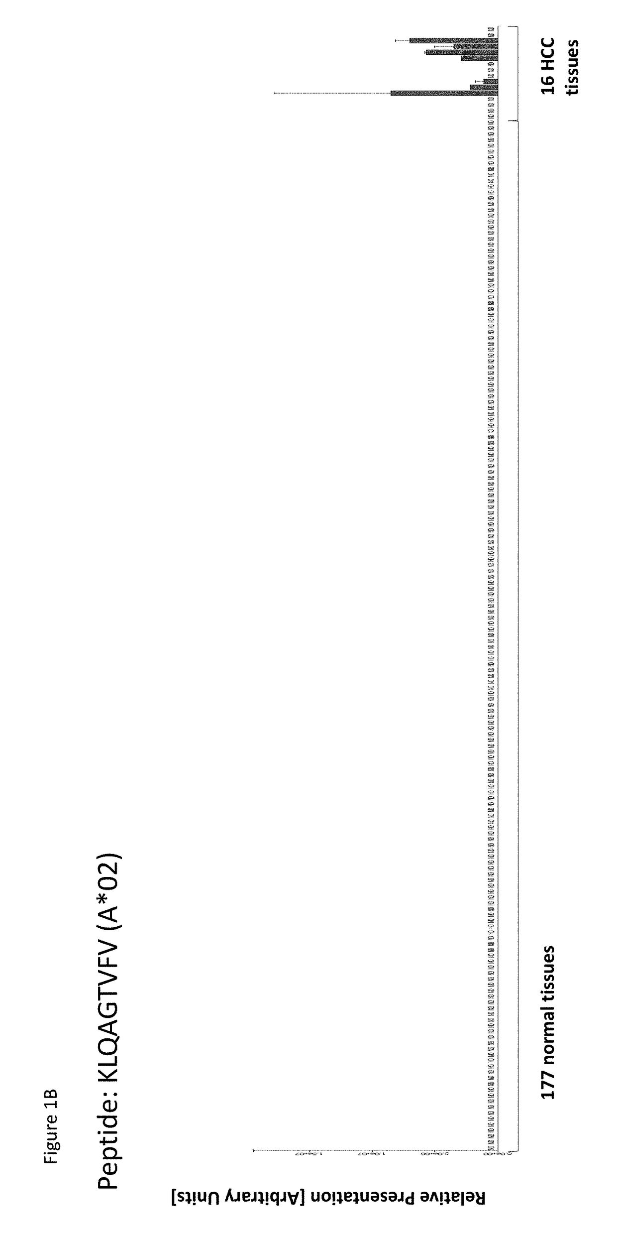 Peptides and combination of peptides for use in immunotherapy against hepatocellular carcinoma (HCC) and other cancers