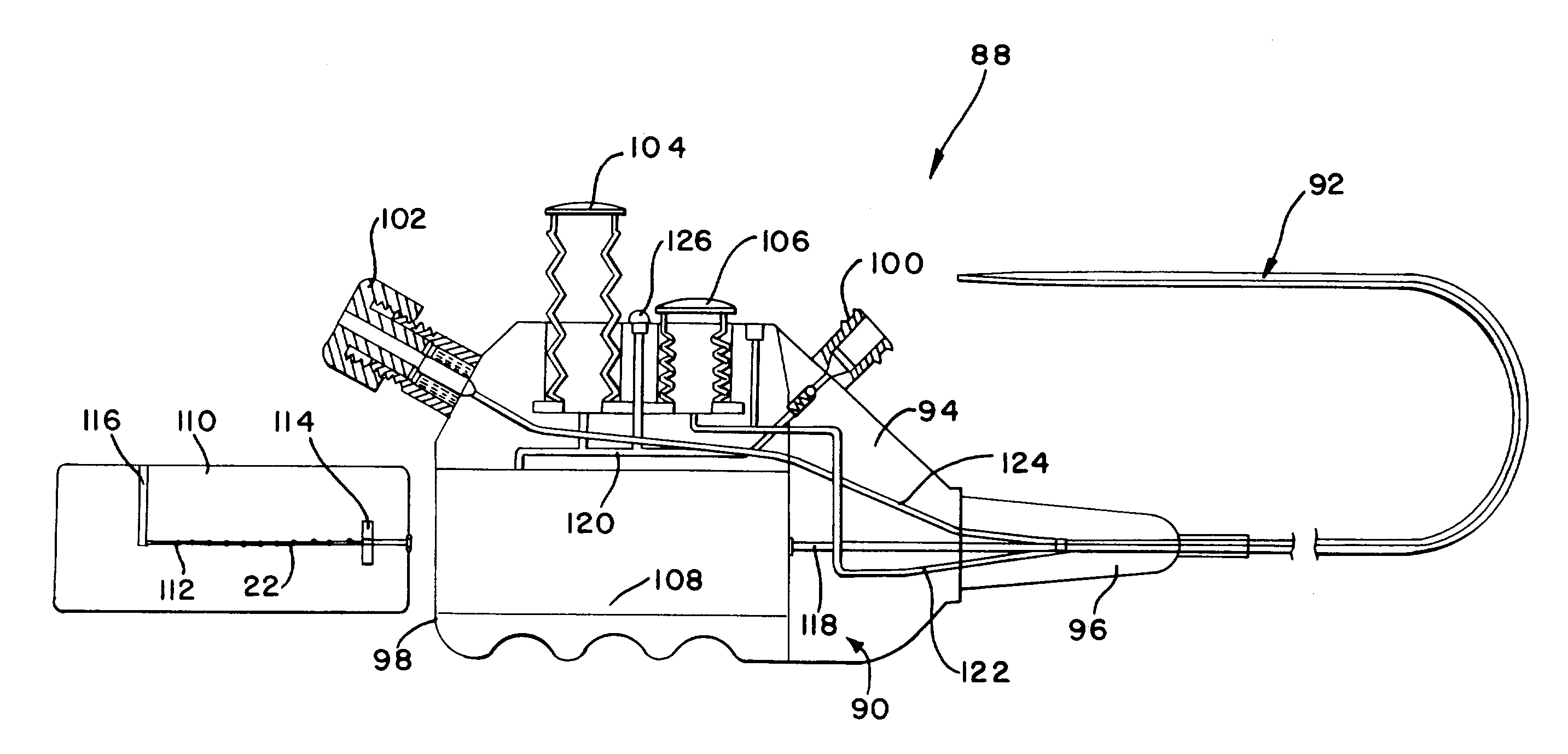 Method and apparatus for treating a desired area in the vascular system of a patient