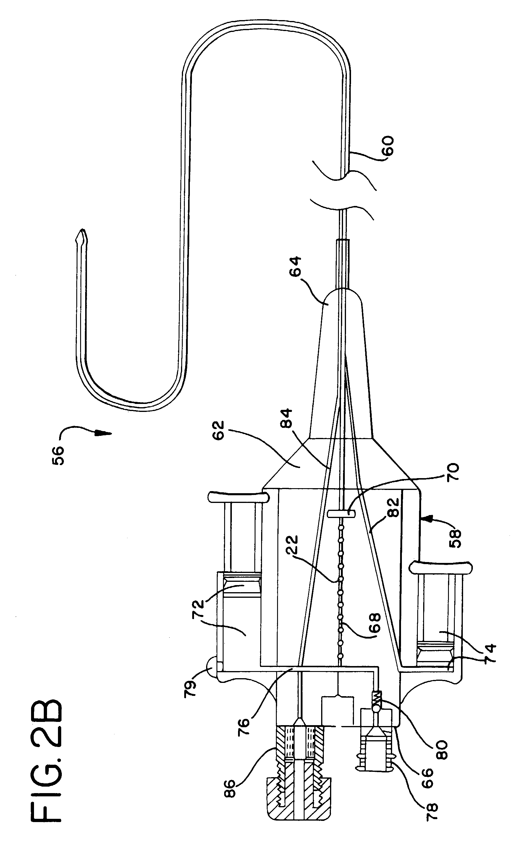 Method and apparatus for treating a desired area in the vascular system of a patient