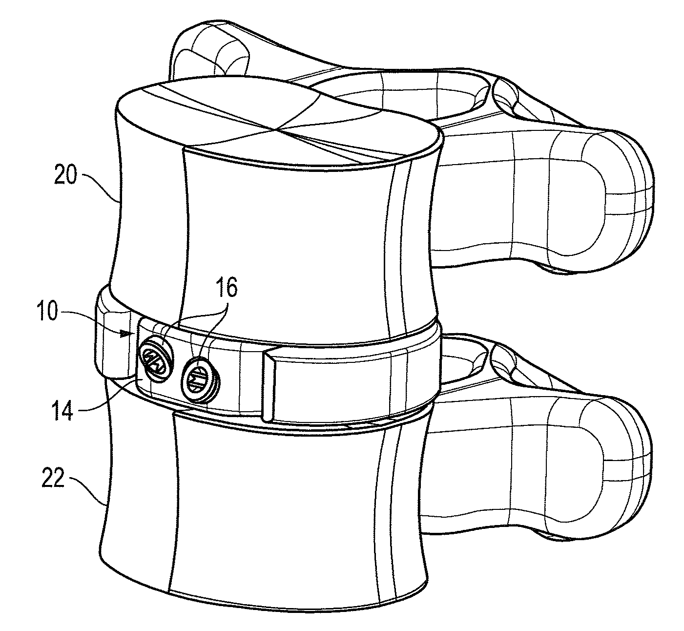 Interbody fusion device with snap on anterior plate and associated methods