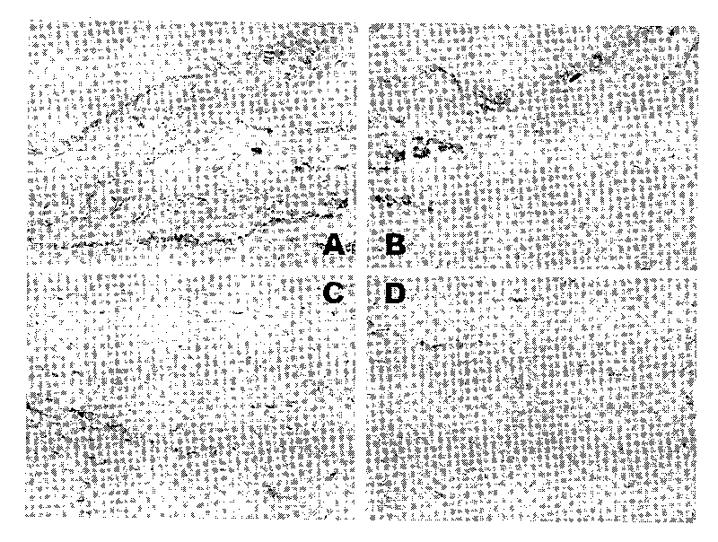 Vaccine eye drops used for treating and preventing glaucoma and preparation method