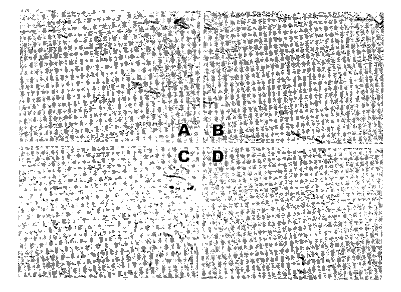 Vaccine eye drops used for treating and preventing glaucoma and preparation method