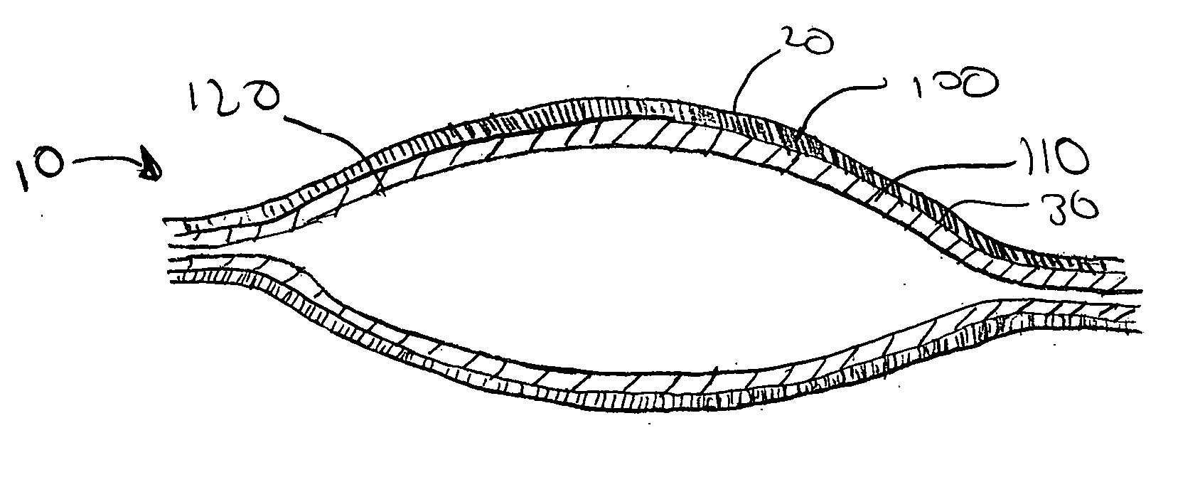 Multi-step method of manufacturing a medical device