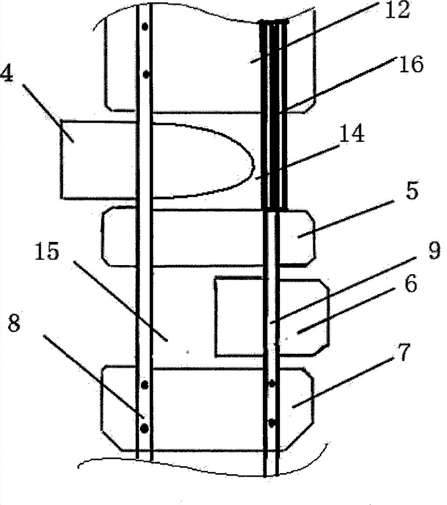 Adjustable conical bearing outer ring turnover device