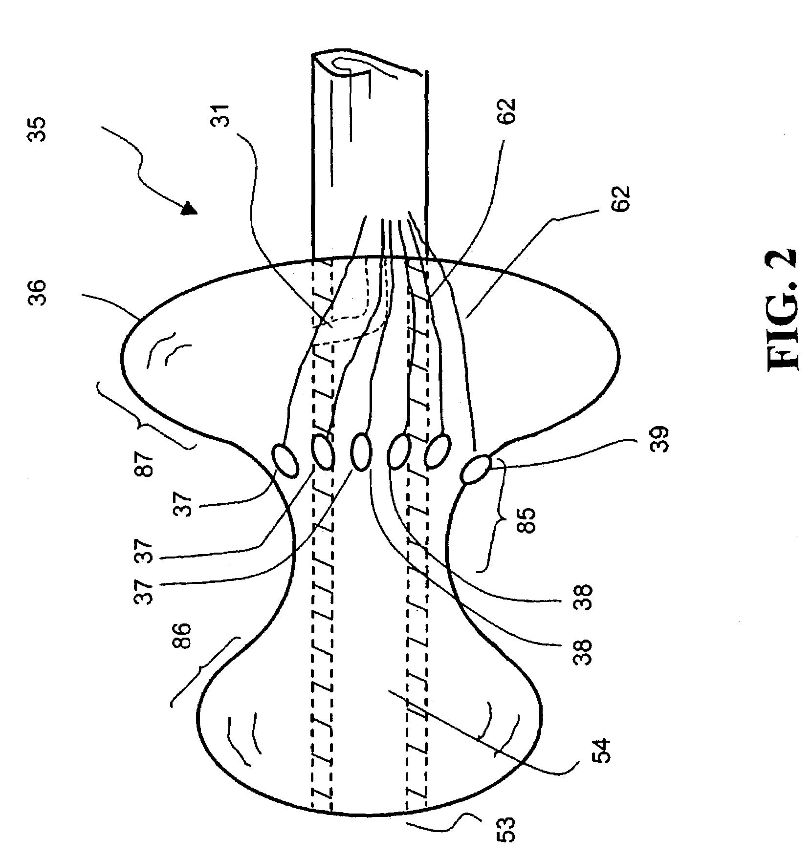 Methods for treating and repairing mitral valve annulus