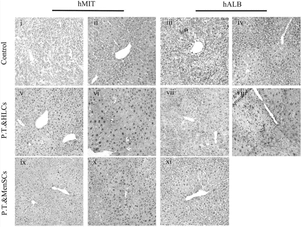 Method for induced differentiation of liver cells by using endometrium stem cells