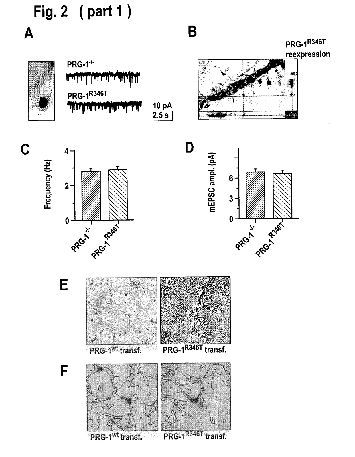 Lpa level reduction for treating central nervous system disorders