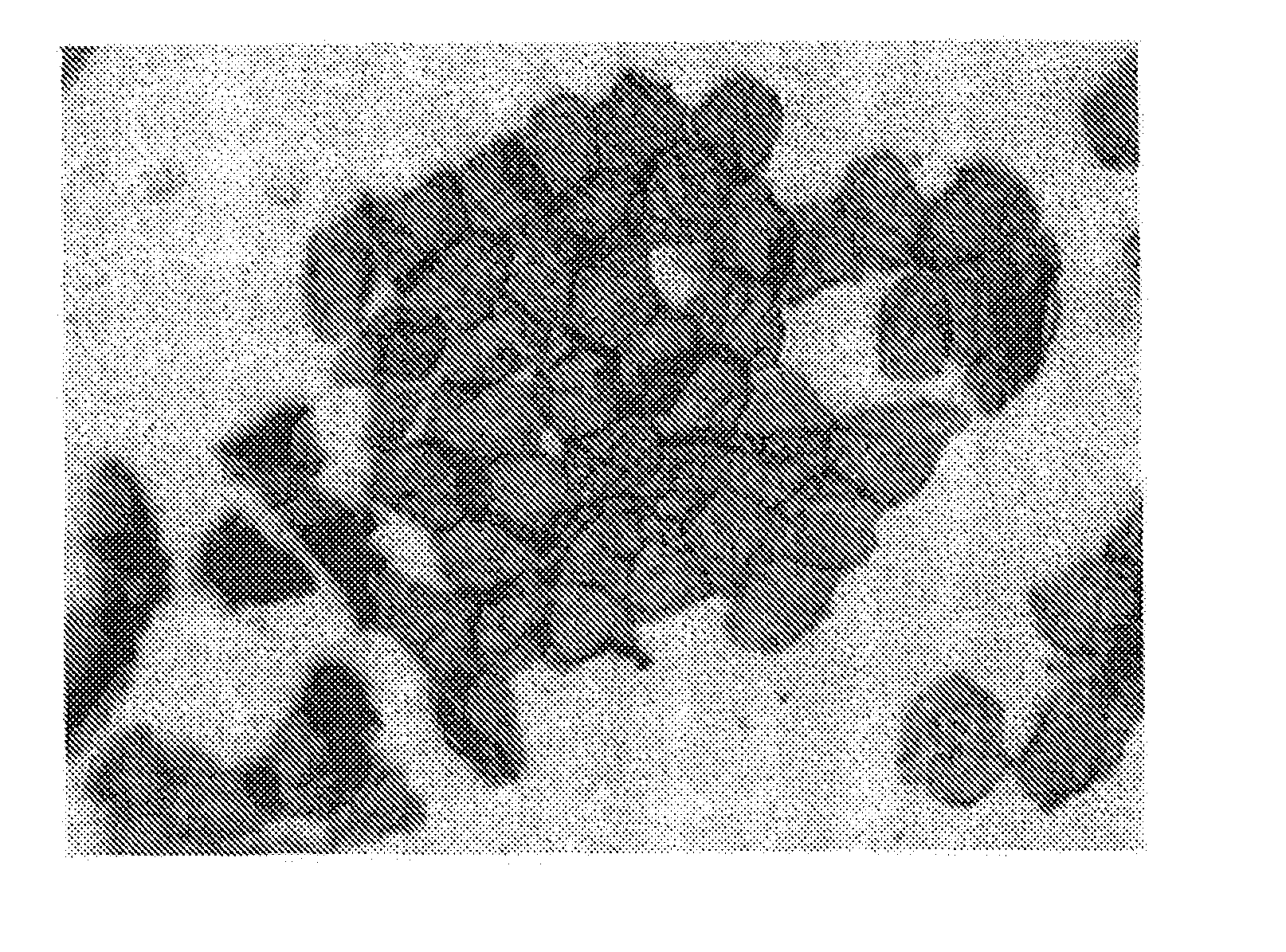 Method of supporting the differentiation of corneocytes