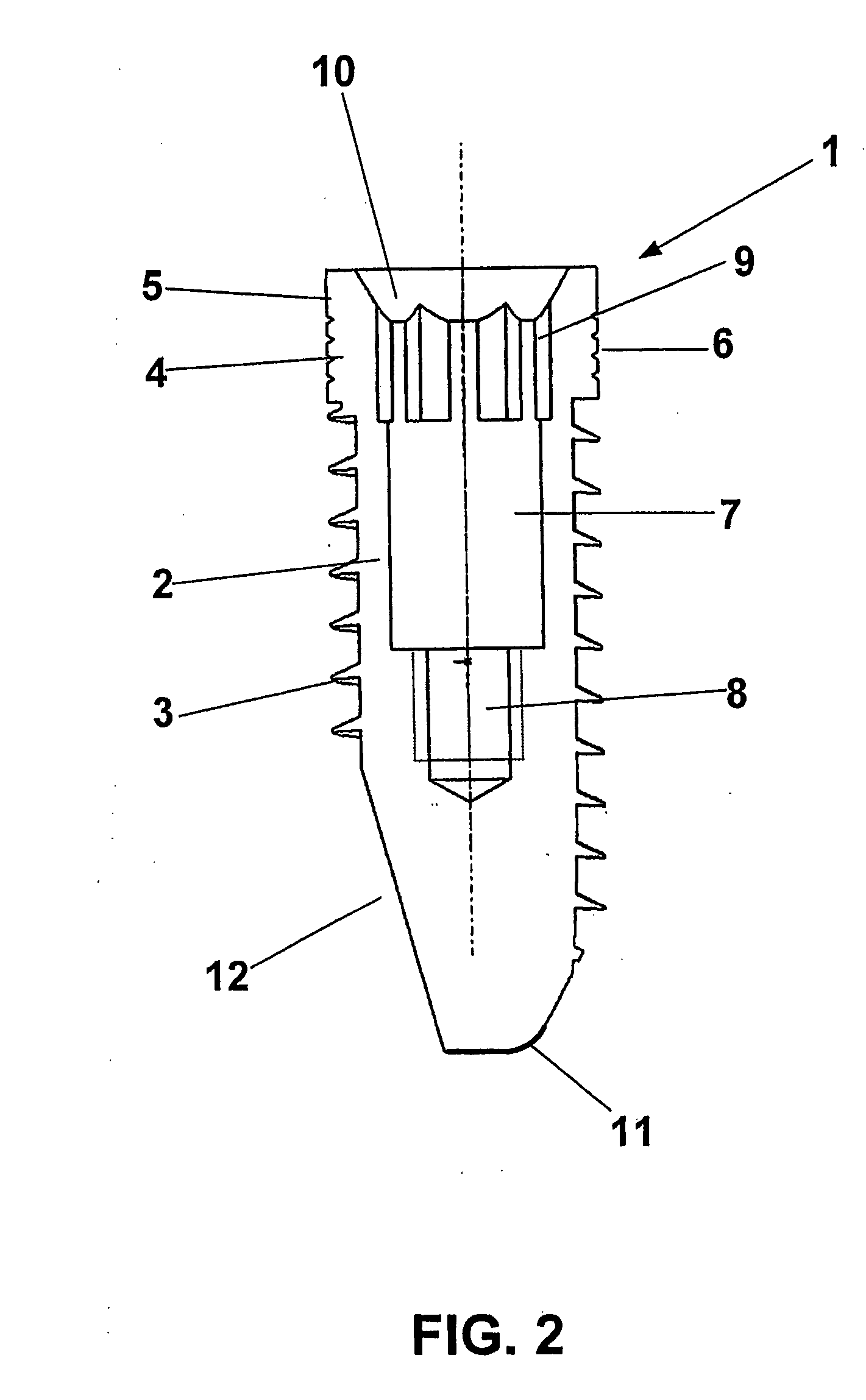 Screw-in Enossal Dental Implant