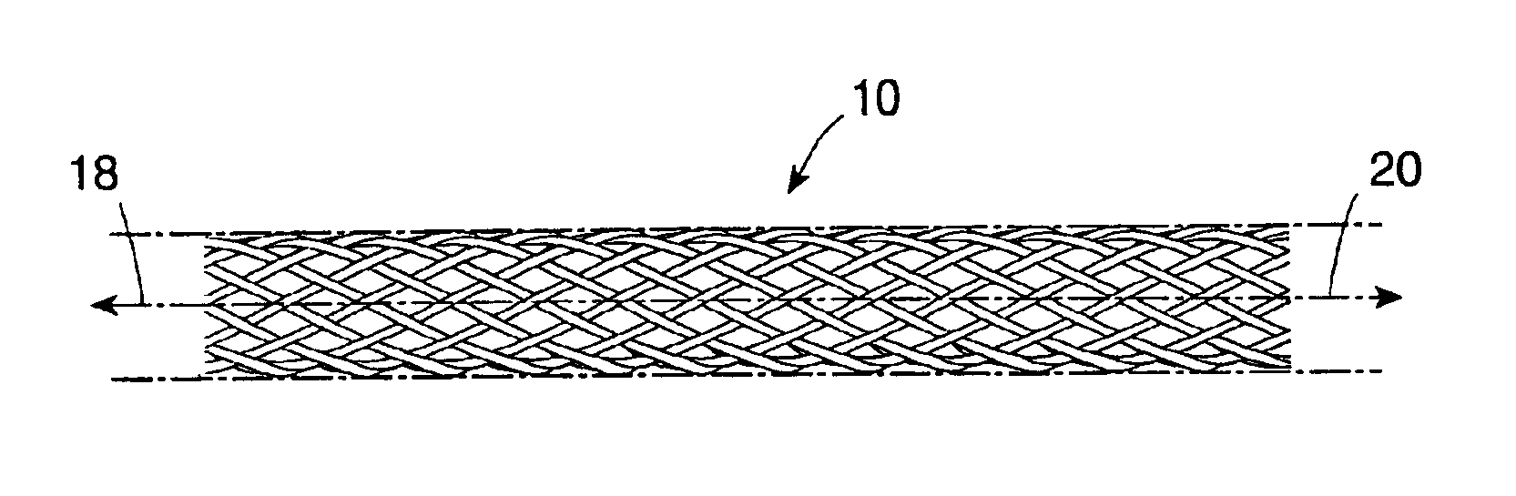 Drug release coated stent