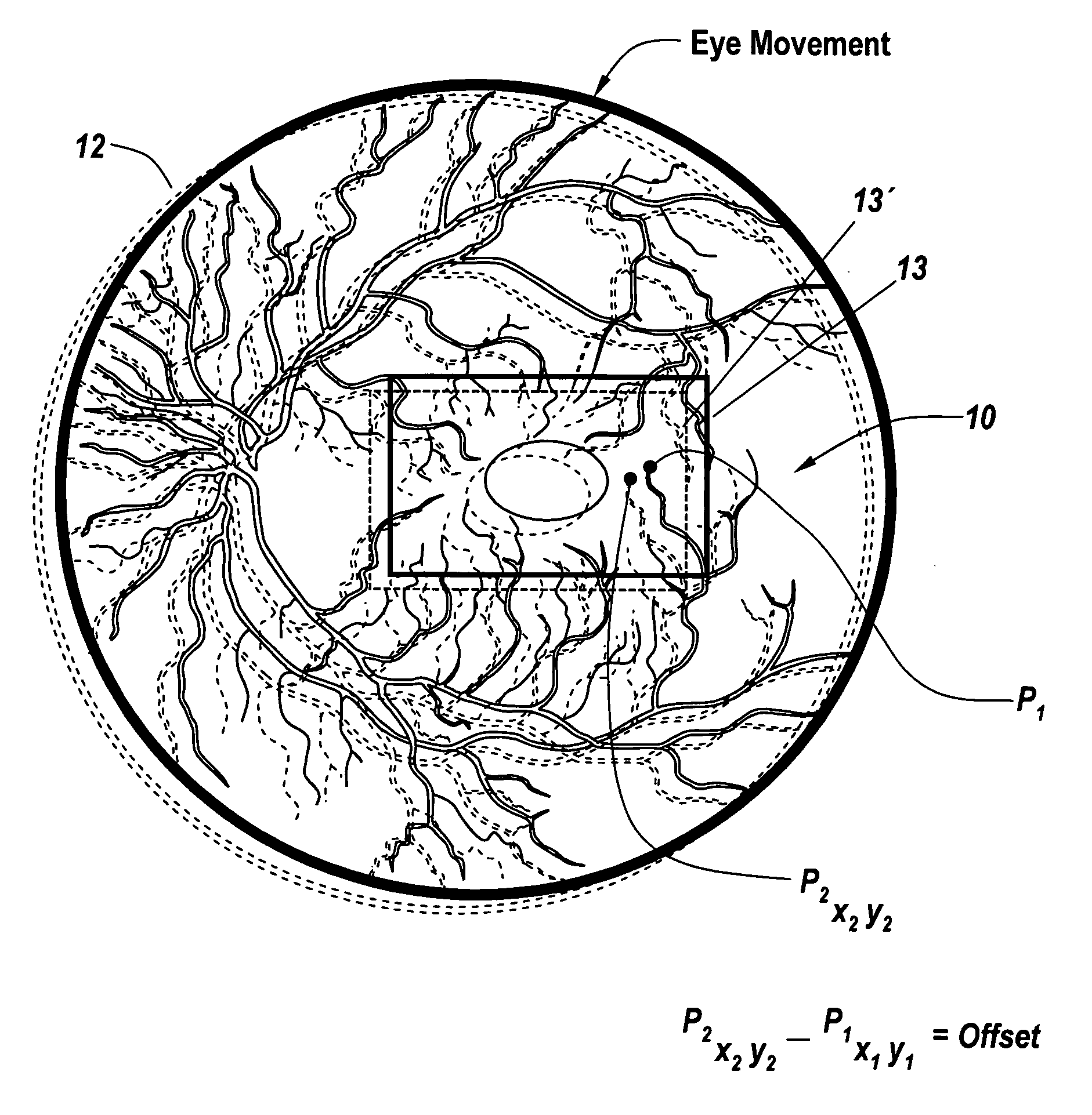 Region based vision tracking system for imaging of the eye for use in optical coherence tomography