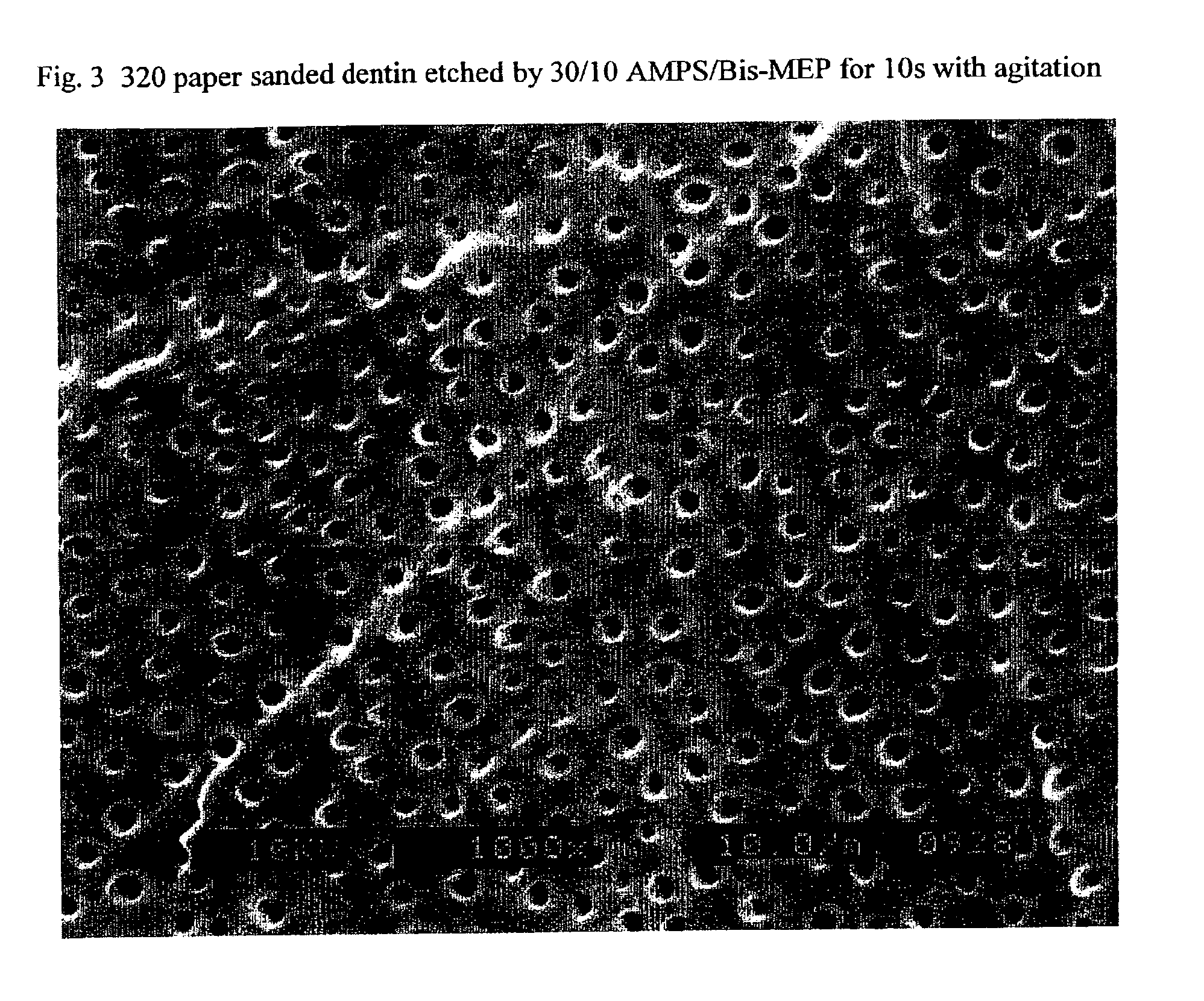 Stable self-etching primer and adhesive bonding resin compositions, systems, and methods