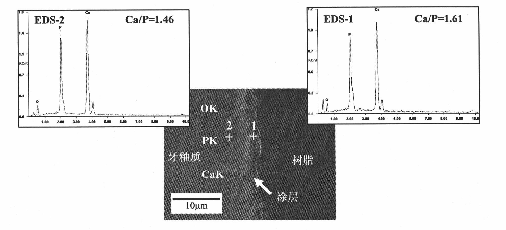 Composition for tooth-surface anticaries repair and preparation method thereof