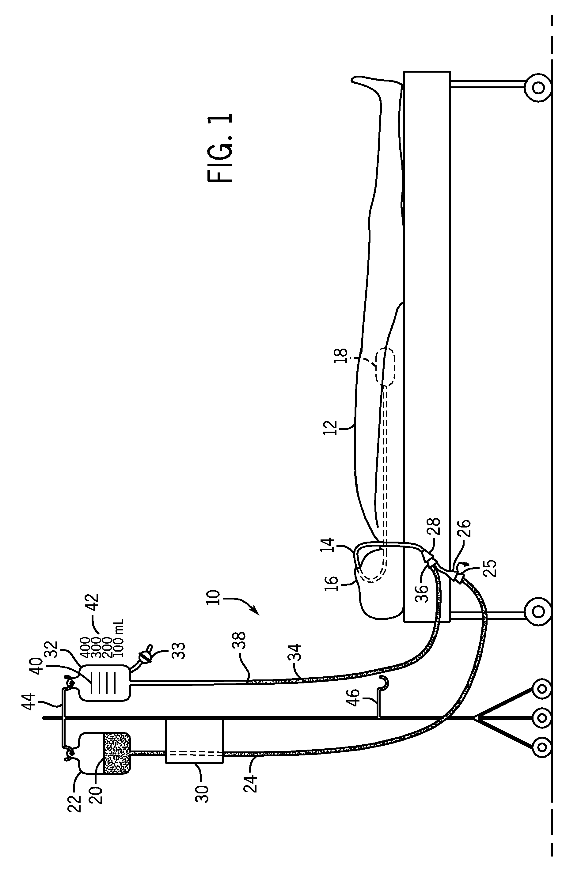 Method and system for the determination of residual volume in patients having an enteral feeding tube