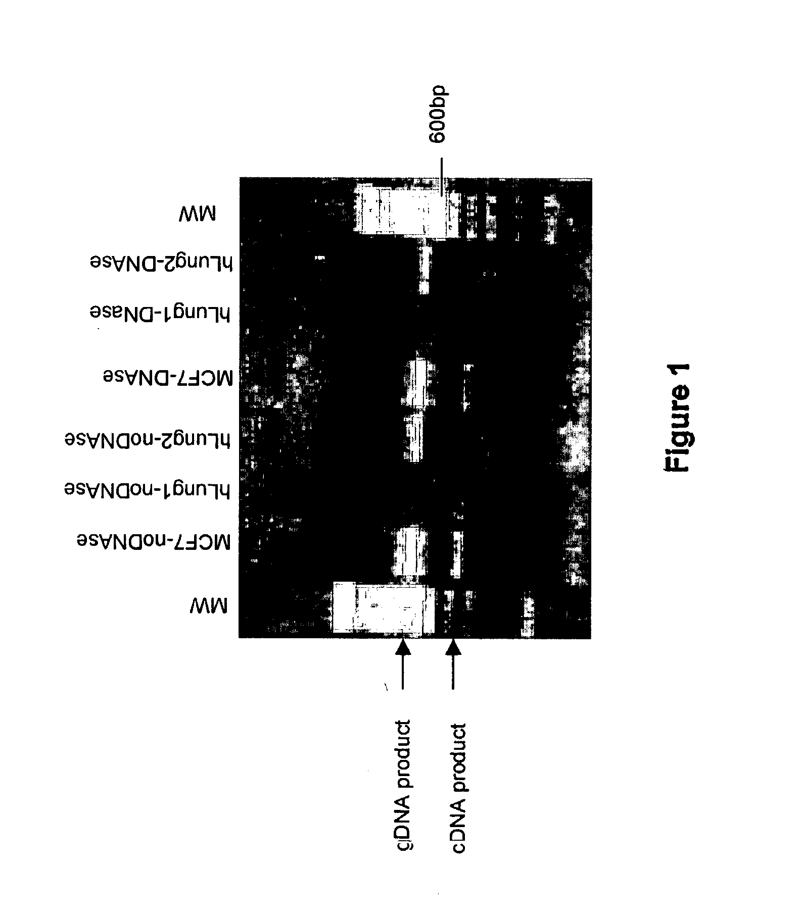 Universal RT-coupled PCR method for the specific amplification of mRNA