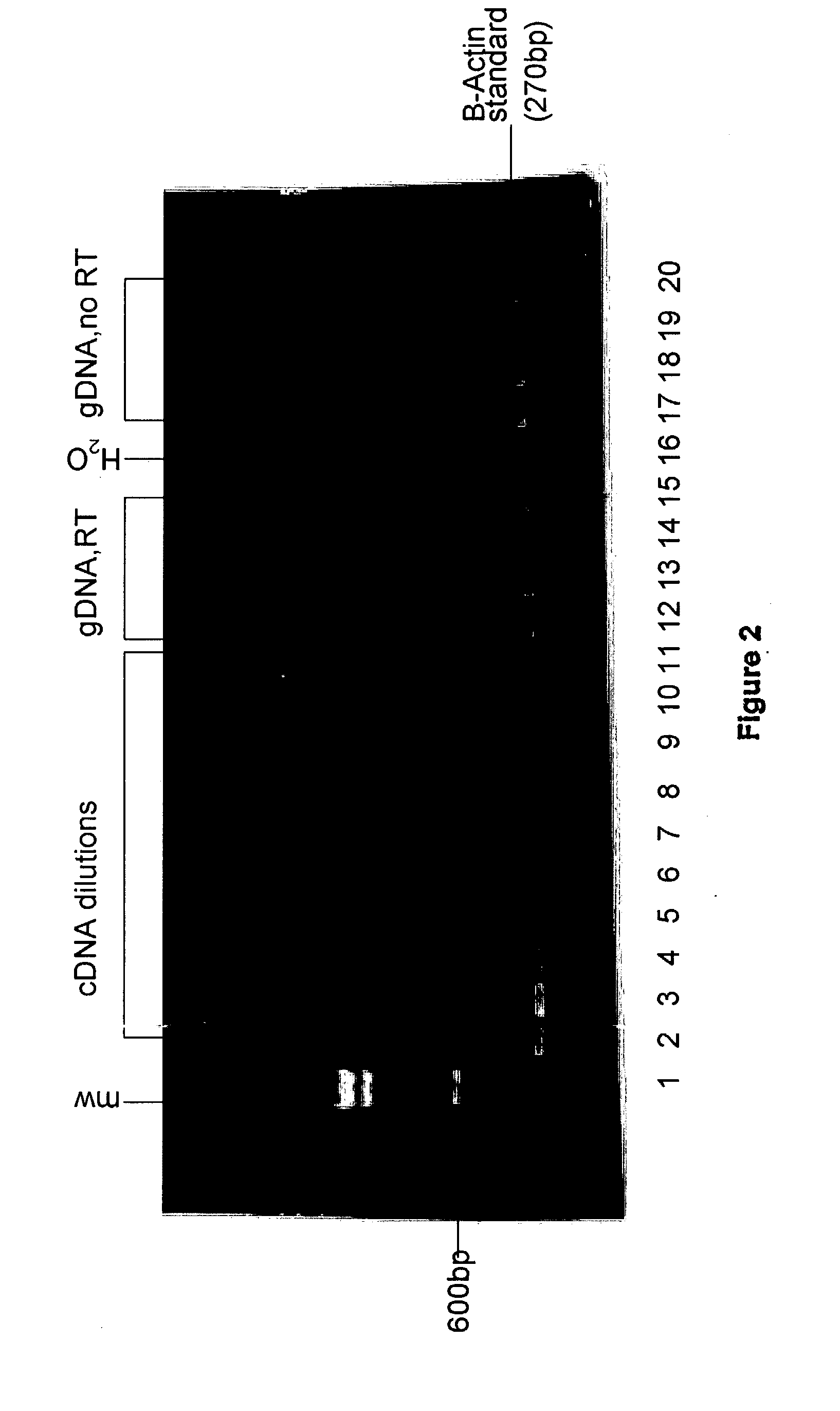 Universal RT-coupled PCR method for the specific amplification of mRNA