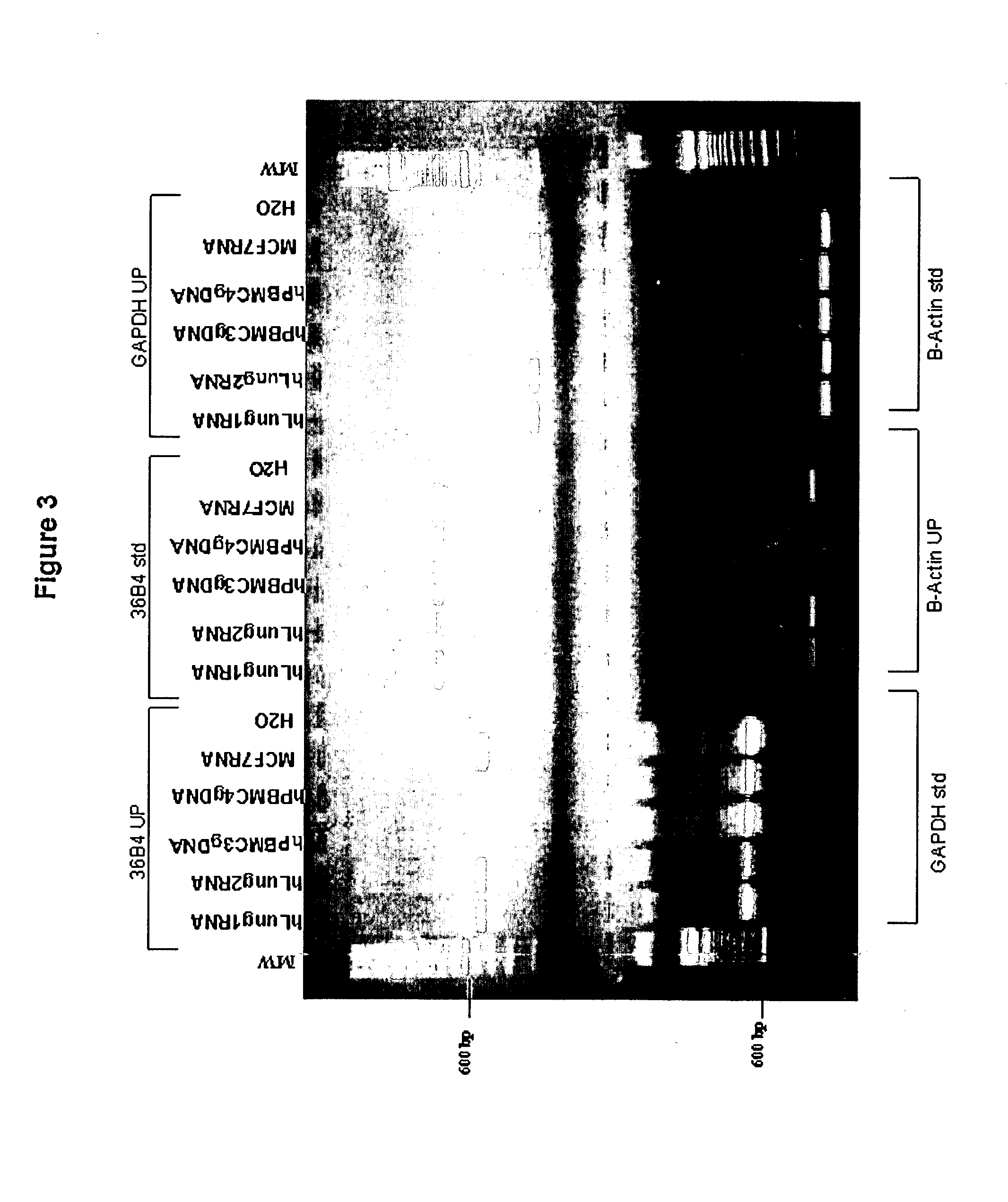 Universal RT-coupled PCR method for the specific amplification of mRNA