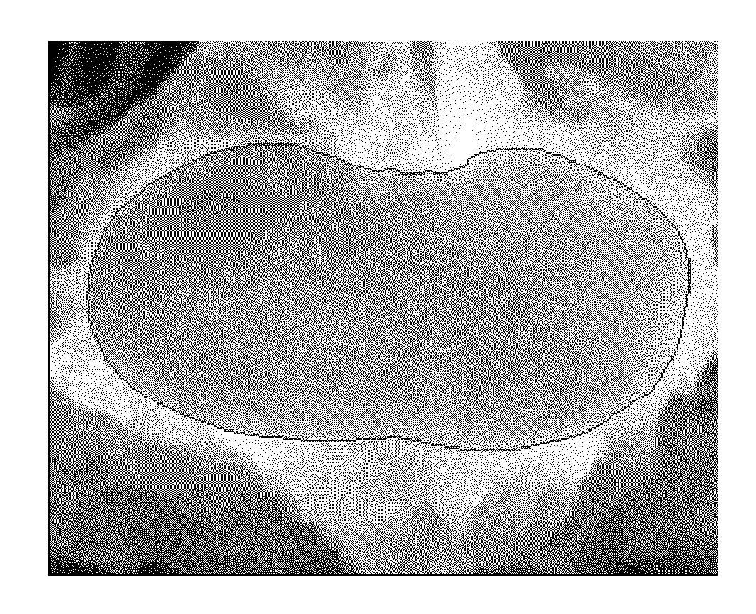 Image registration method for medical image sequences