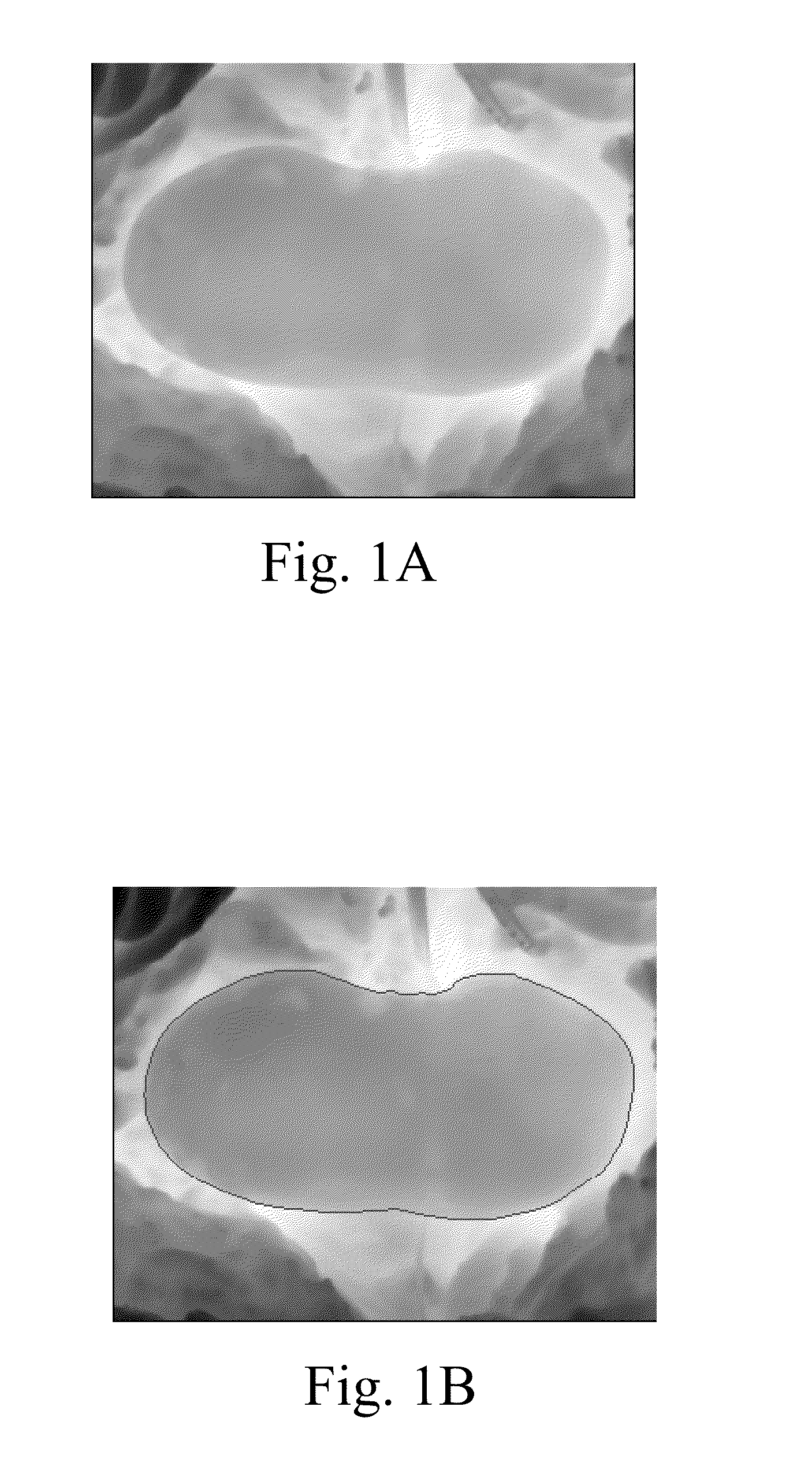 Image registration method for medical image sequences