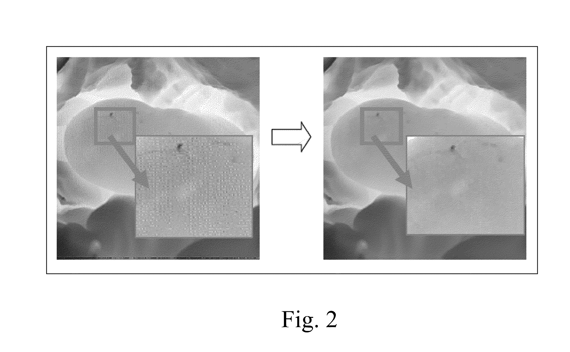 Image registration method for medical image sequences