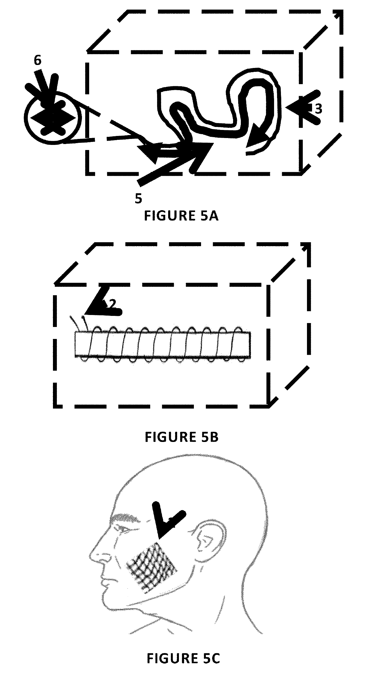 Skin-augmenting surgical sutures