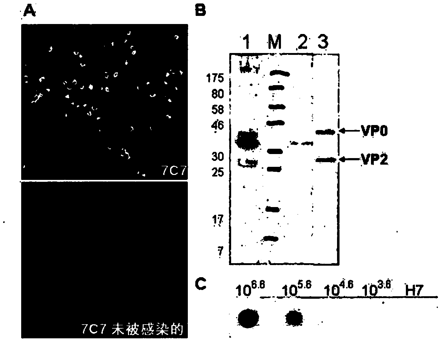 Human enterovirus specific antibodies and their uses in diagnostics