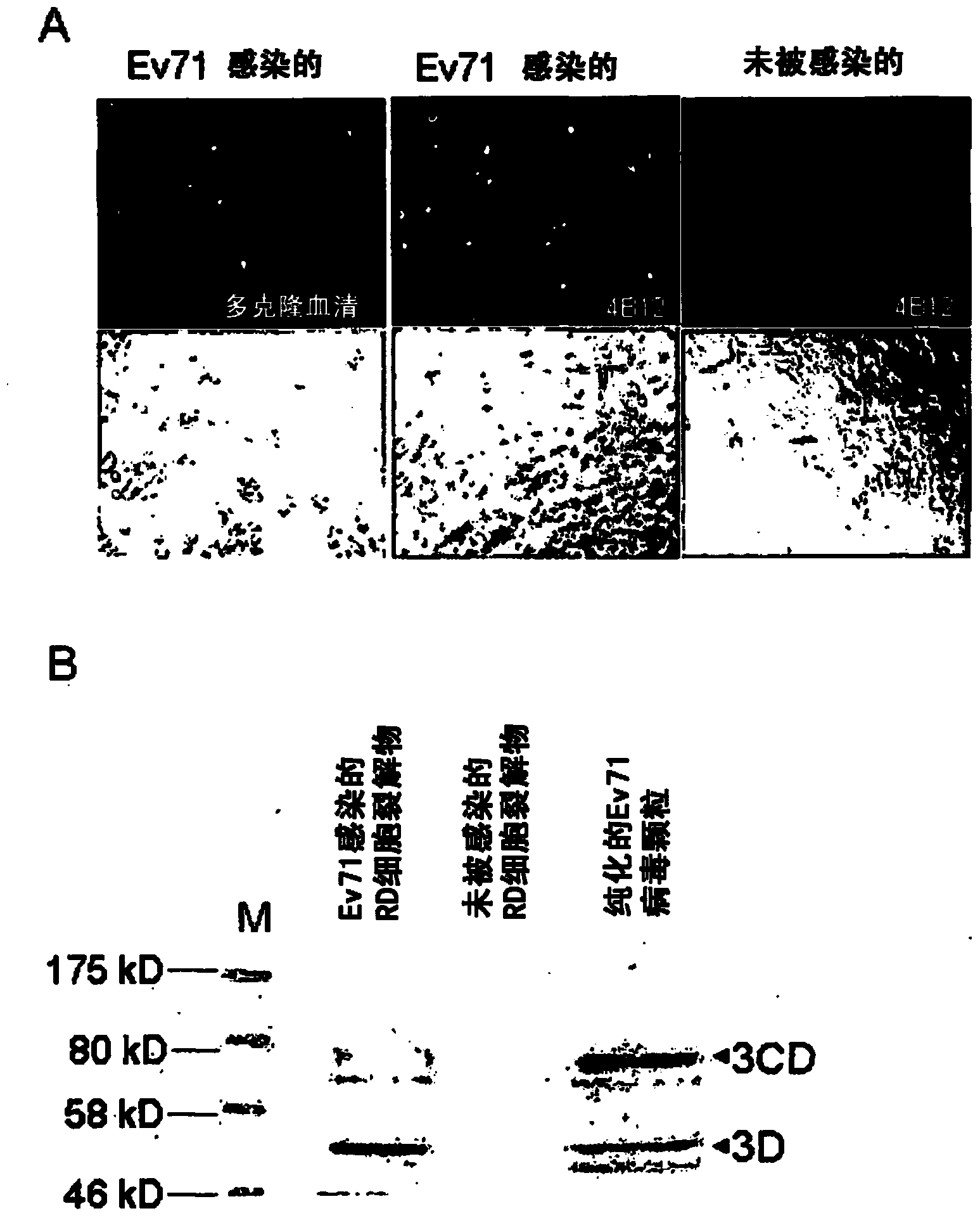 Human enterovirus specific antibodies and their uses in diagnostics