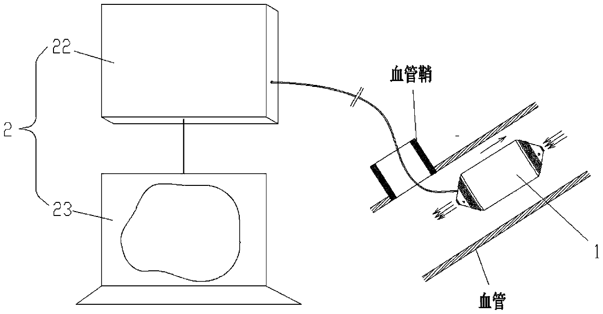 A precisely controllable vascular surgical robot and its operating method